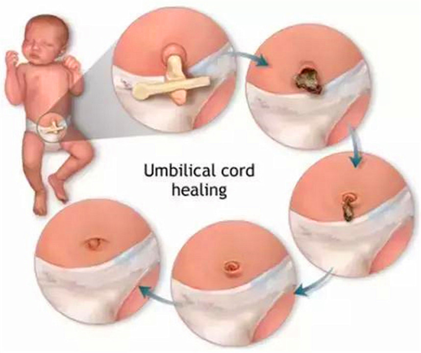 肚脐眼里的泥用显微镜放大,肚脐眼用显微镜放大1000倍
