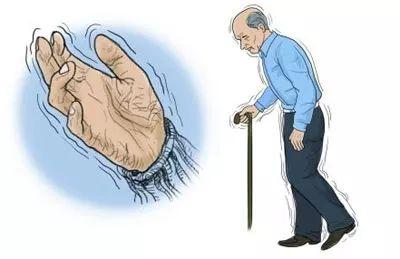 帕金森病非运动症状治疗推荐,帕金森运动障碍怎么吃药