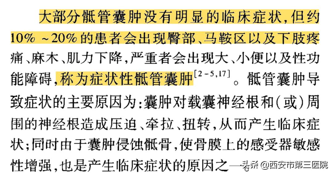 【医者解读】揭开“骶管囊肿”之神秘面纱，查出骶管囊肿都需要治疗吗？（手术病例+文献回顾）