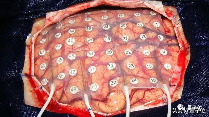 最强读心术！脑波直接转语音，你的秘密已无处藏身｜Nature子刊