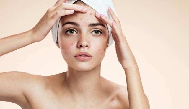 红霉素软膏,涂在脸上,会有什么变化?这些年不知道,“亏大”了