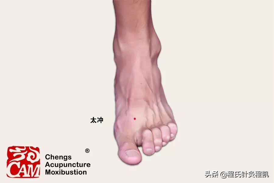 “大动肝火”导致头晕头痛、烦躁易怒,中医三招降肝火