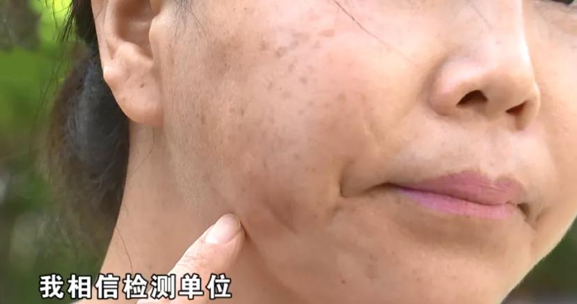 做完抽脂脸上有凹陷,脸颊两边抽脂后有鼓包怎么回事