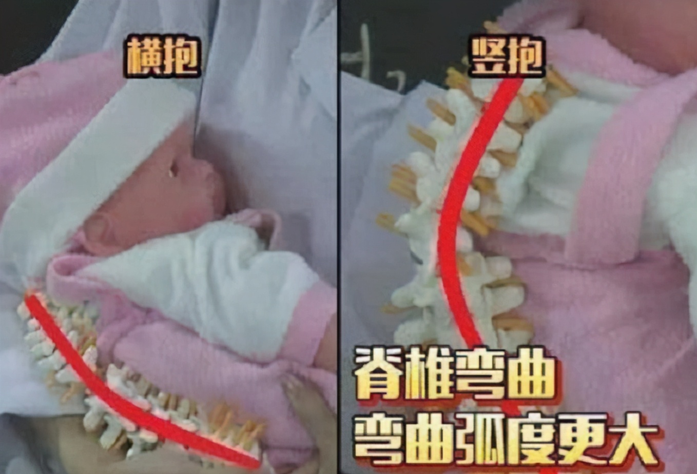 六个月婴儿脊椎变形视频,4个半月婴儿的脊椎