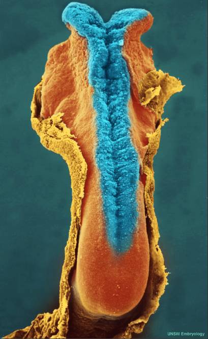 人类是真的经过设计的吗,大胆的推测