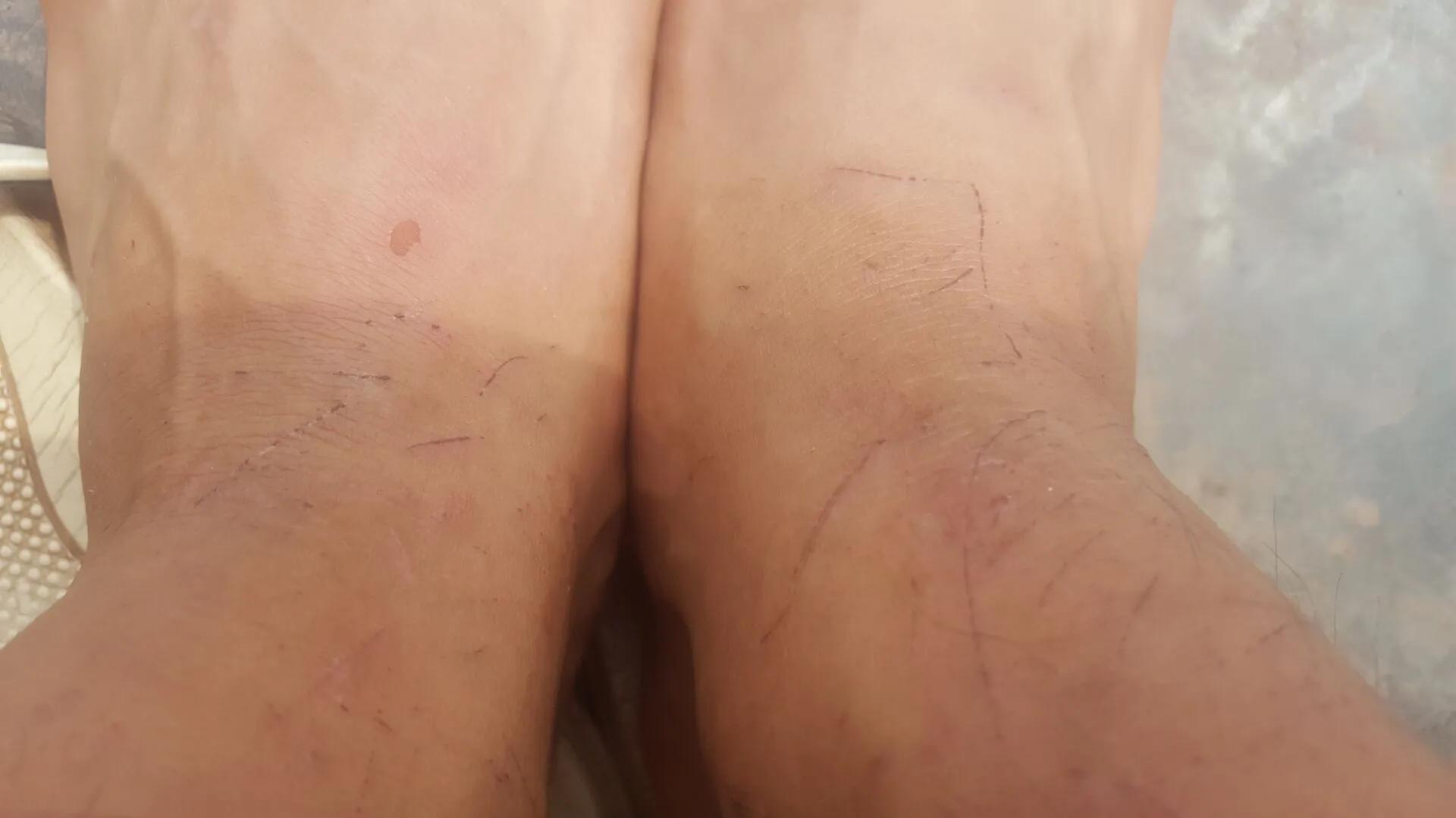 鸡枞菌菇,野生鸡枞