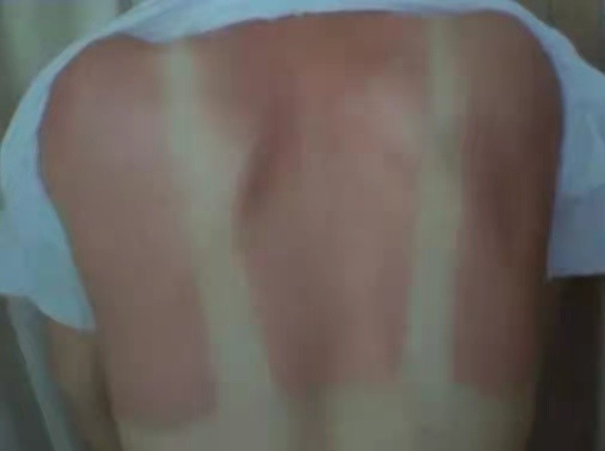 炎炎夏日谨防三类常见病,炎炎夏日谨防空调病