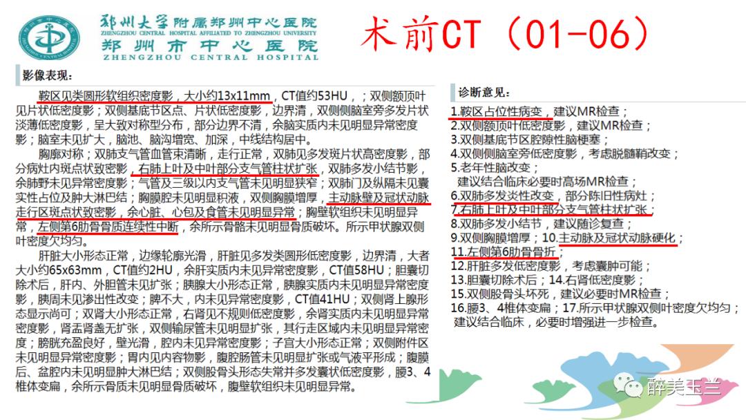 局麻药中毒的术前用药口诀,局麻药中毒临床表现及处理流程ppt