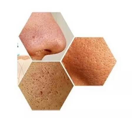 毛孔粗大收缩毛孔最有效的土法,教大家几招改善毛孔粗大的小技巧