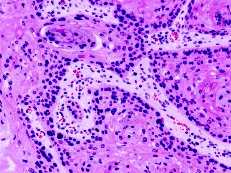 治愈癌症还有多远？科学家成功标记肿瘤干细胞，锁定“癌症之源”