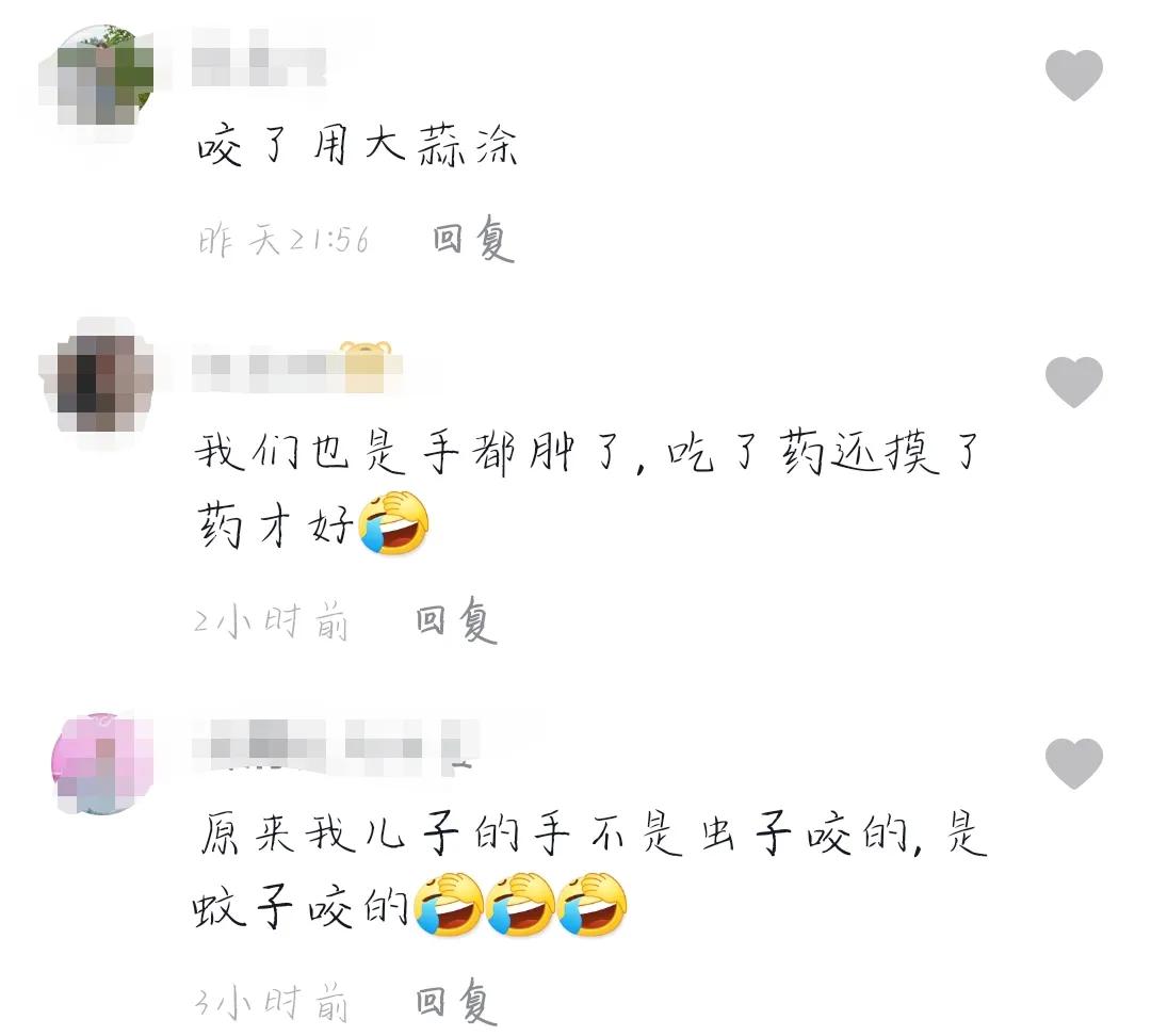 宝宝被蚊子咬后手肿得像面包,被蚊子叮肿了嘴巴小孩