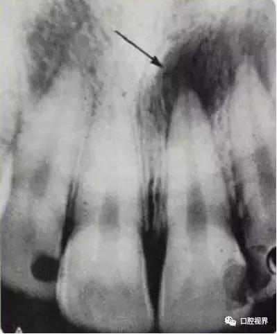 牙疼不是病但疼起来是真的要命,牙疼不是病疼起来真要命是谁说的