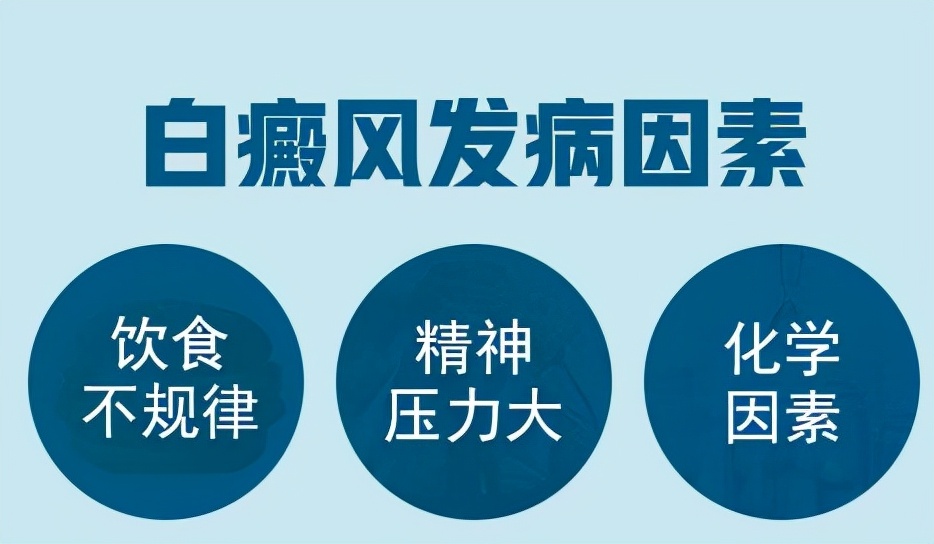 白癜风灯光治疗能治疗好吗,治疗白癜风有效的外用药