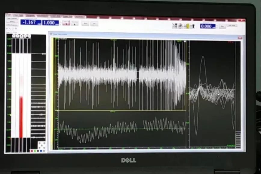 大理帕金森治疗,大理州第一人民医院新院区