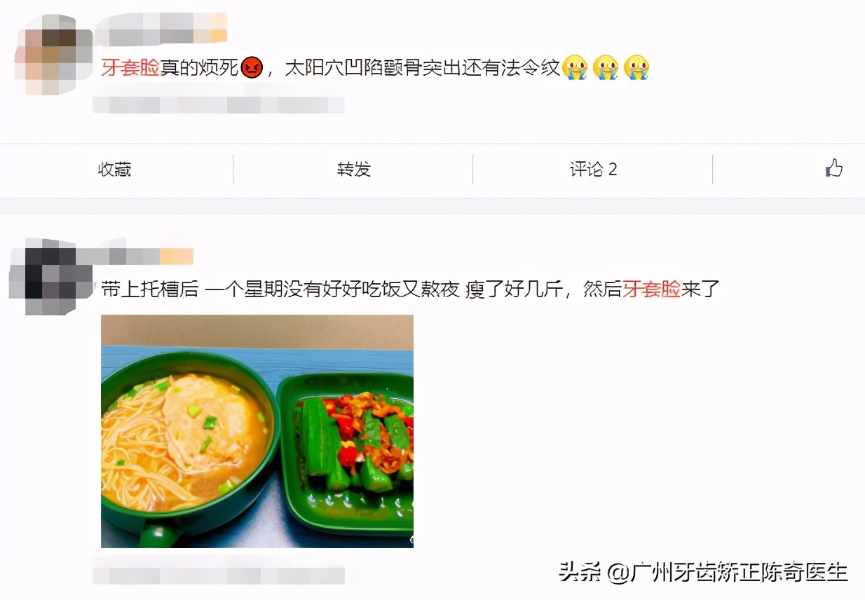 戴牙套会有下颌线,戴牙套的时候人会变丑吗