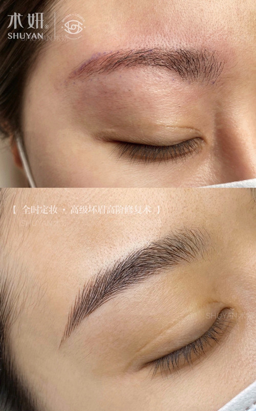 纹眉后红眉能掉了吗,纹眉红眉转色后3个月了还是红