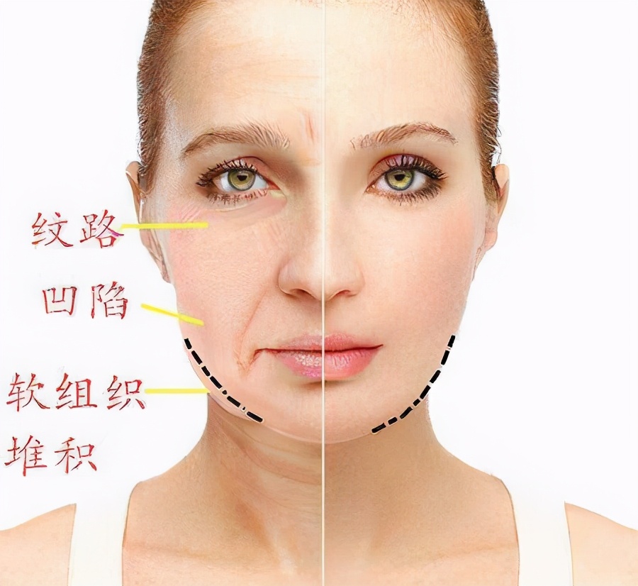 如何改善咬肌鹅蛋脸,咬肌变大脸发腮怎么改善