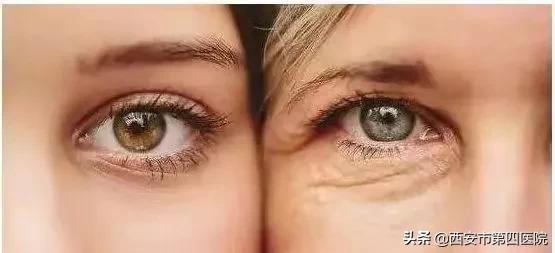 提眉术后注意事项及禁忌,提眉术能改善哪些问题