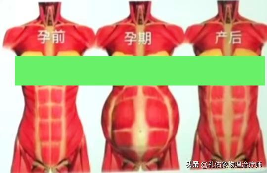 生完孩子后女人都有的苦恼,生完孩子的女人有哪些痛苦