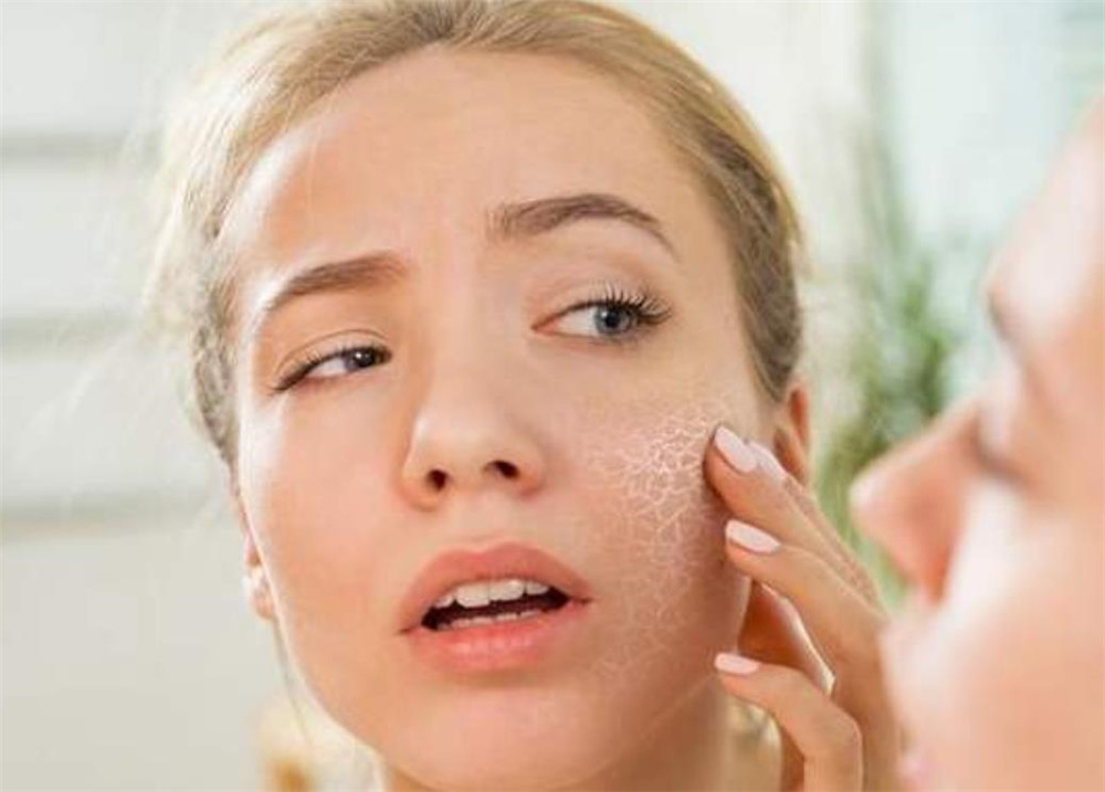 糟了!入秋后皮肤敏感红肿刺痛该咋办?做到这四点告别“红脸蛋”