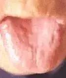 老中医舌苔从厚变薄了,任博士老中医讲舌苔