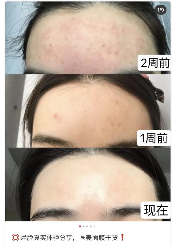 面膜的真面目,面膜是否真实有效