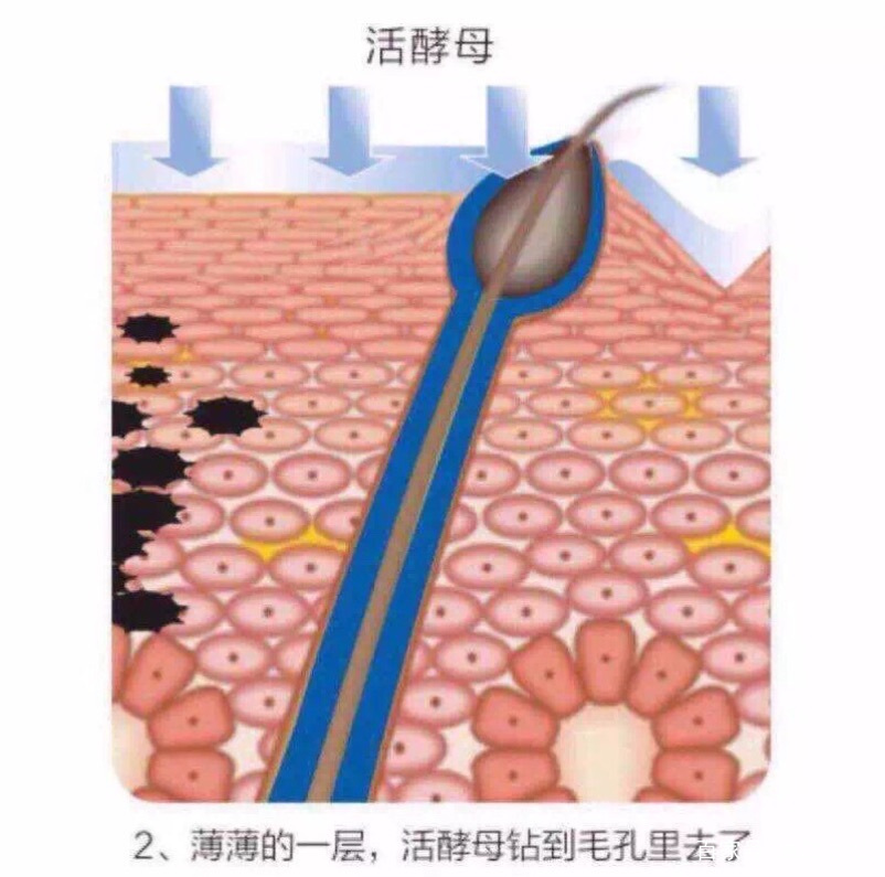 张庭活酵母面膜靠谱吗,张庭用了24年的活酵母
