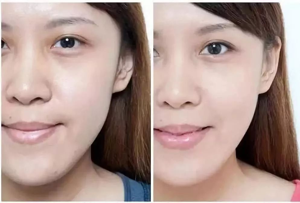 改善眼角细纹的方法有哪些,眼角皱纹细纹怎么去掉