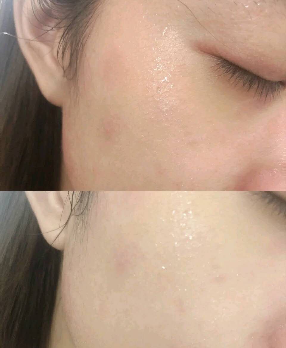 张艺兴晒的国货之光面膜火了，称屈臣氏断货王，网友：贼好用