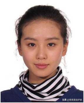 黑眼圈的类型及医美治疗方法,黑眼圈用什么方法拯救才好