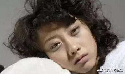 有黑眼圈是因为熬夜还是睡眠不足,失眠黑眼圈严重怎么改善黑眼圈