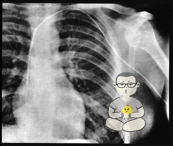 不可思议！25岁年轻医生用导尿管自插心脏完成史上首例心导管术