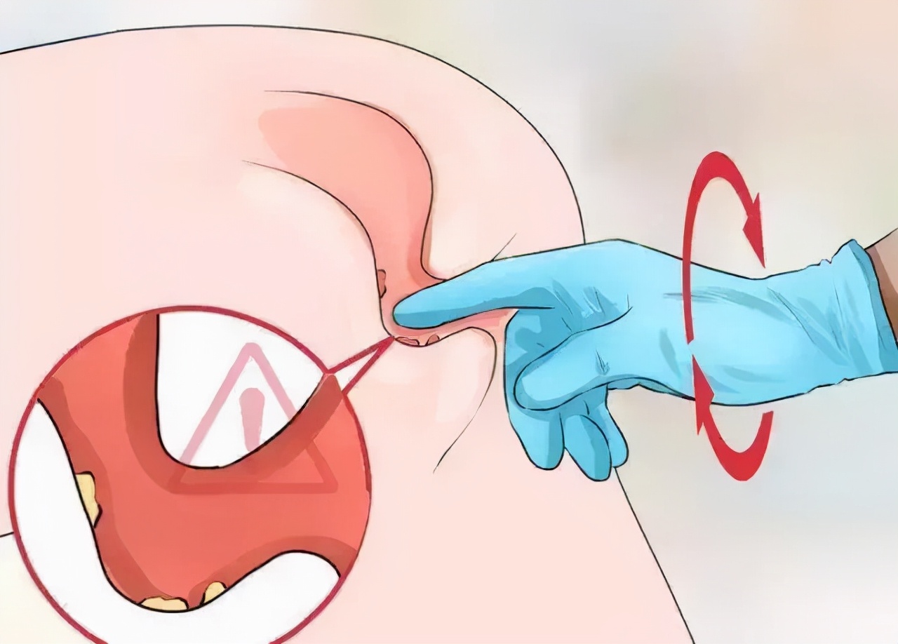 拉屎拉出一个小肉球,拉屎拉出小肉球