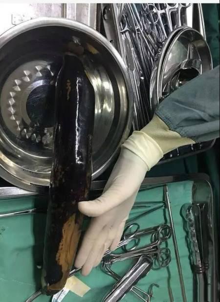 辟谣医生手术时捶打患者,辟谣手术