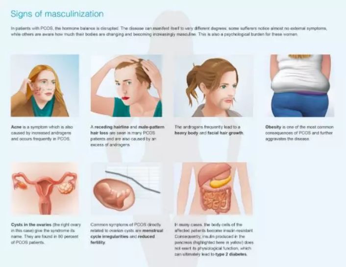 美肤霜说明书,多囊卵巢痤疮用什么药