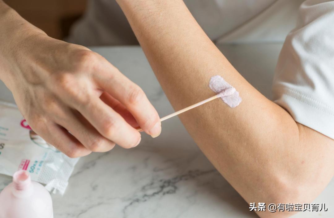 哪种湿疹膏最好用又安全,最好用的湿疹膏