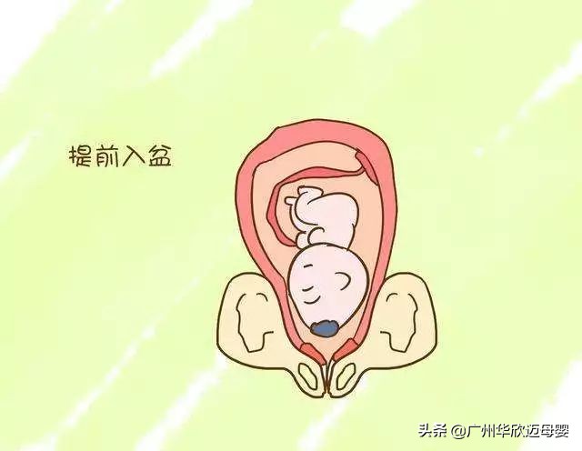 胎儿入盆是什么时候发动,胎儿入盆需要多久完成入盆