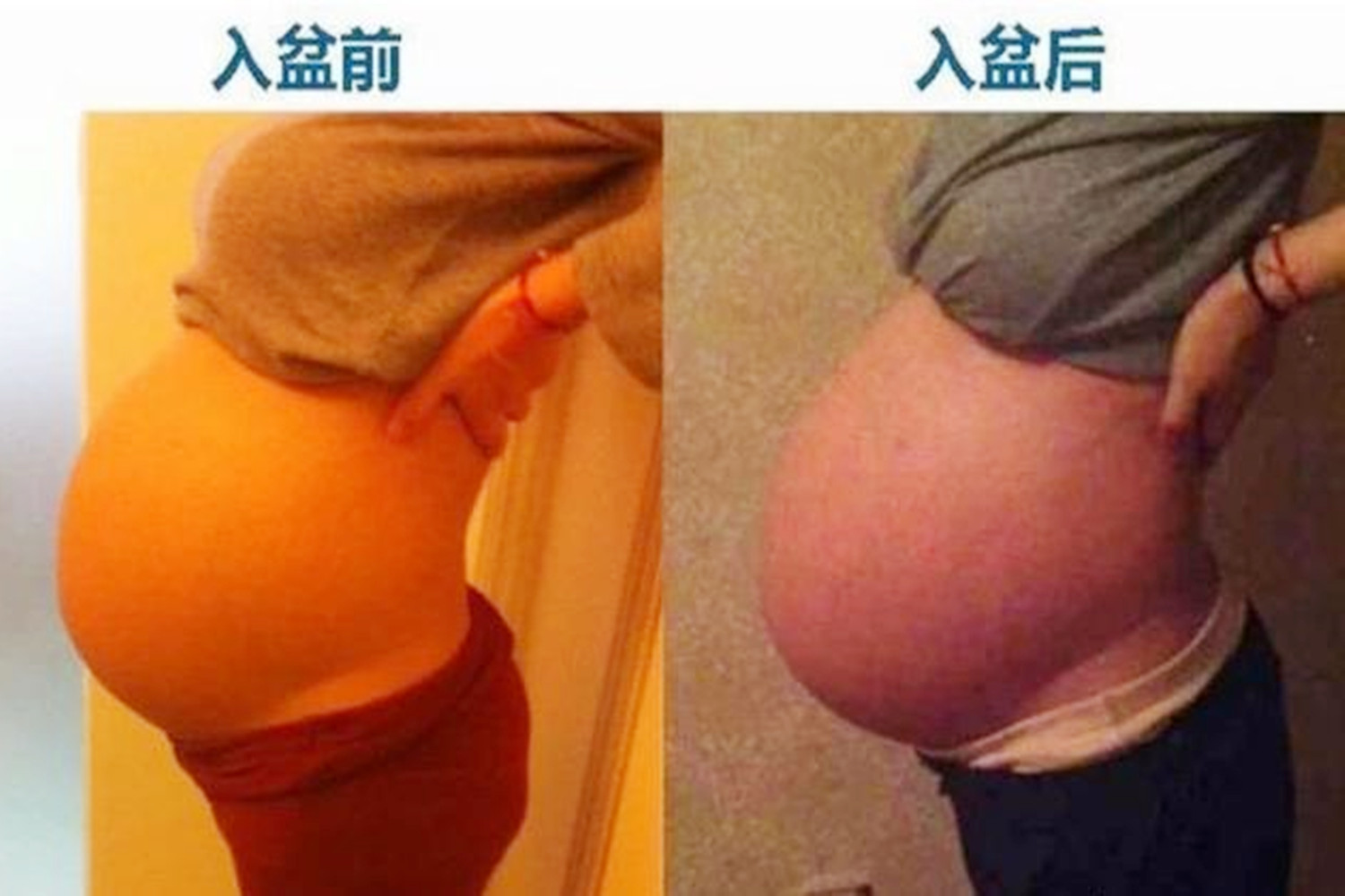 怎么判断胎儿是不是入盆了,怎么判断胎儿是否入盆