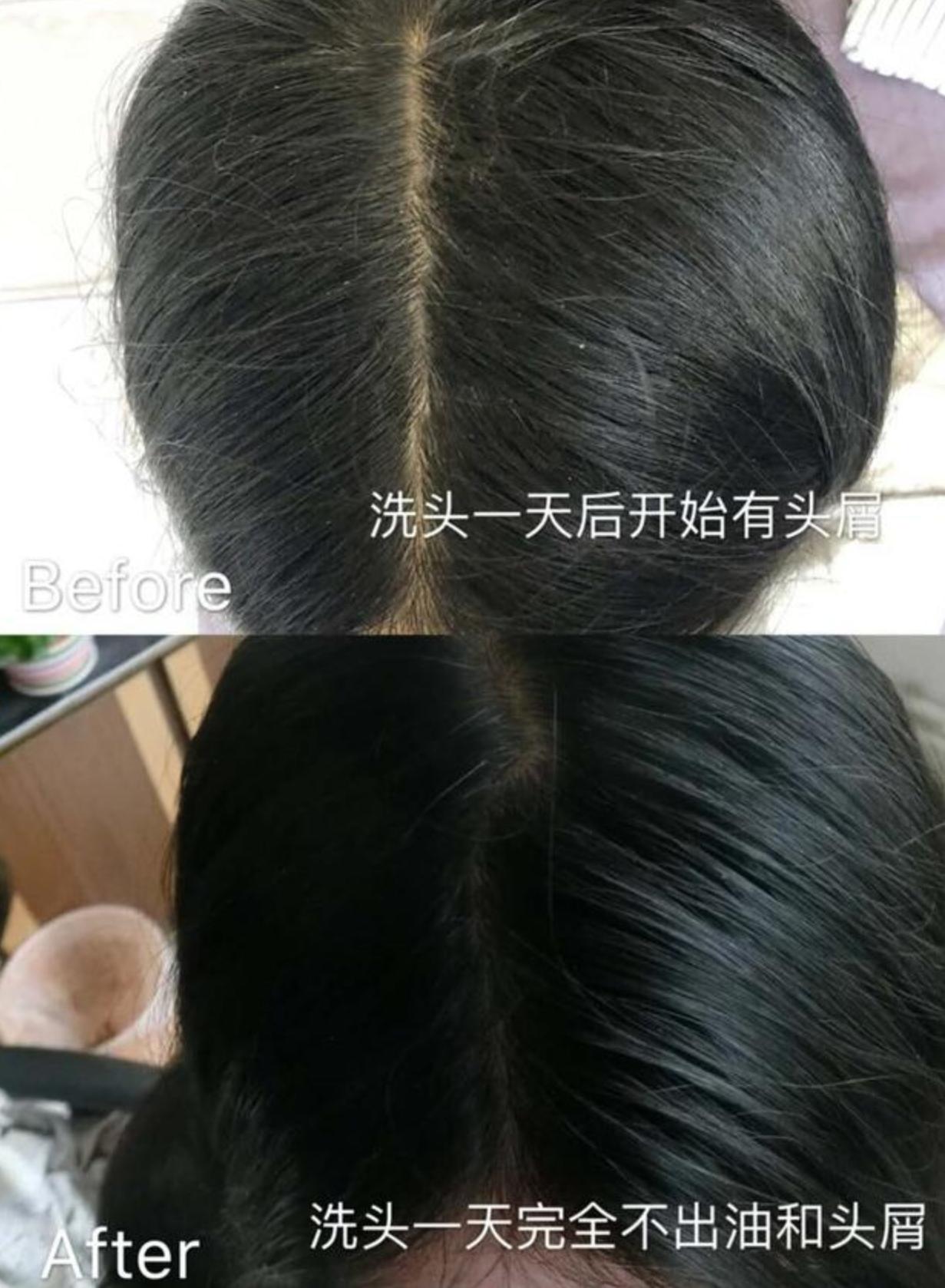 海飞丝和飘柔洗发水哪个是国货,海飞丝日本进口洗发水