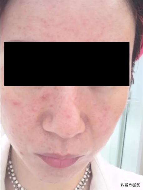 自嘲整容,承认整容七年的姐姐