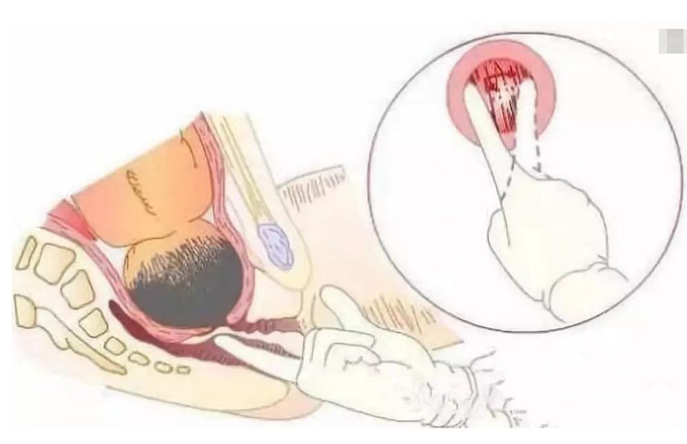 孕晚期检查一大难关，内检细节老公听了想打人，孕妇尴尬又心酸