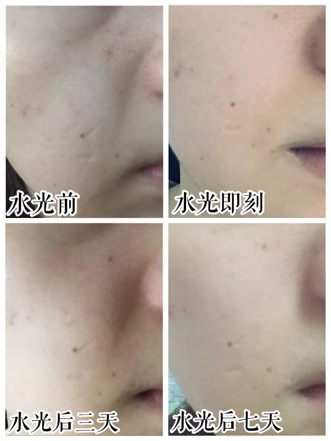 几百的水光仪和几千的区别,几百块钱的水光效果评测