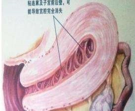 月经量减少的鉴别诊断,月经变少怎么调理气血