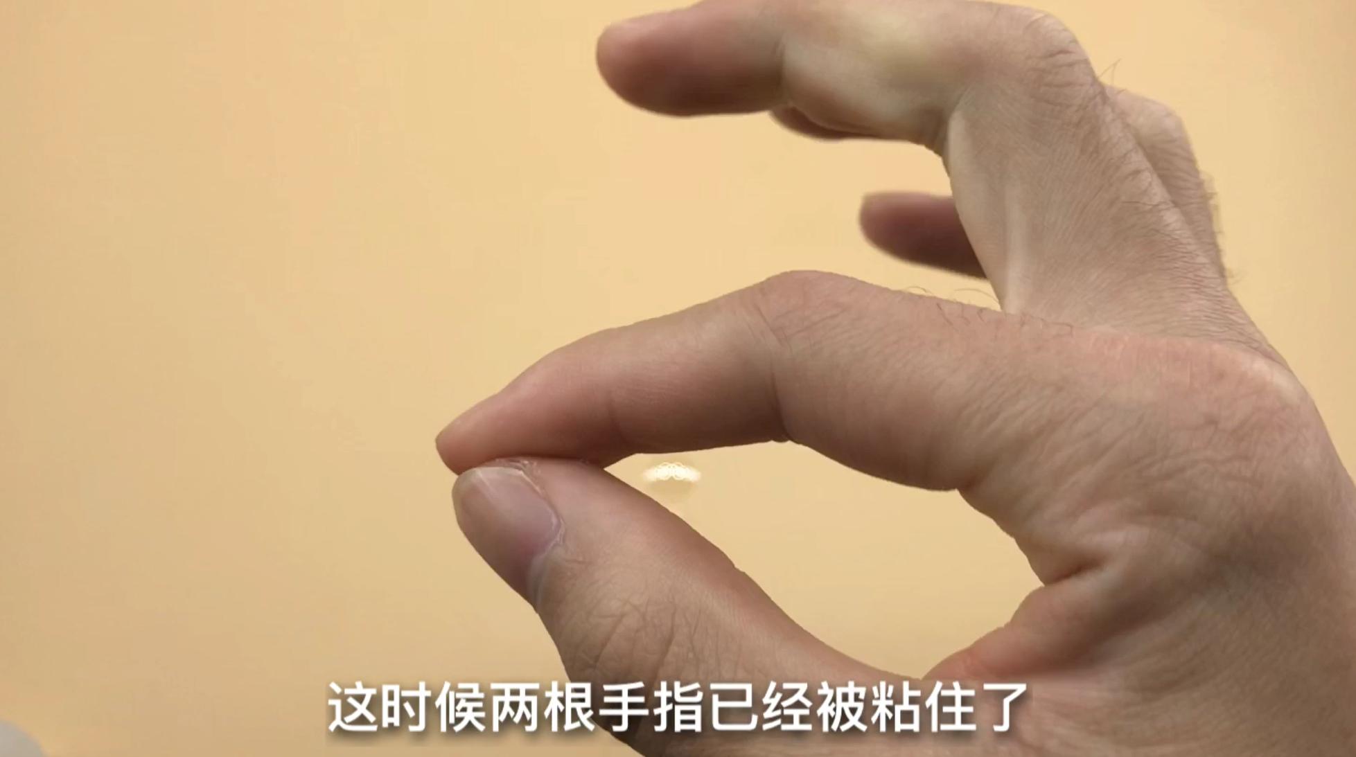 手指粘了502很久都好不了怎么办,502把手指和木棍粘在一起怎么办