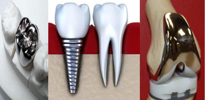 膝关节骨性关节炎症状及治疗,膝关节骨性关节炎诊疗指南下载