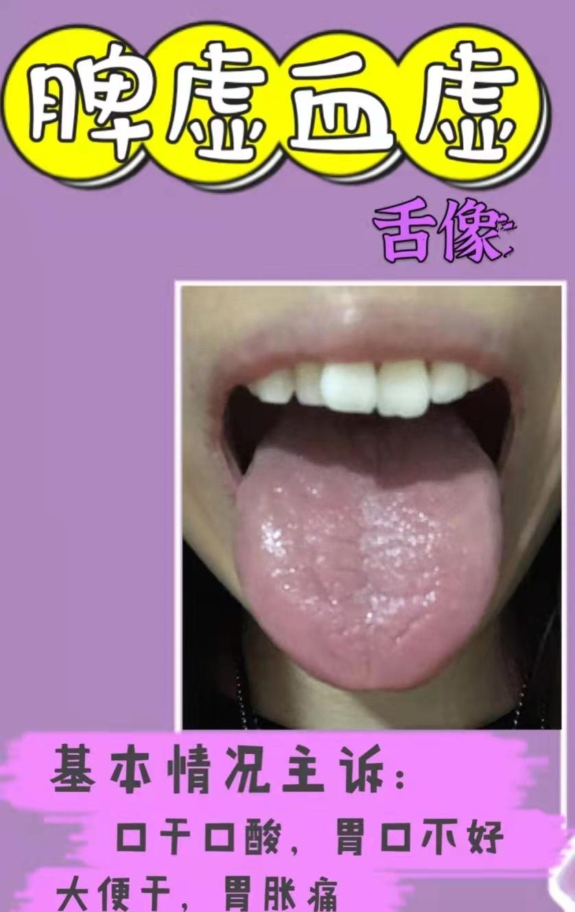 健脾胃治脾胃不和中成药,脾胃不好百病生怎么办