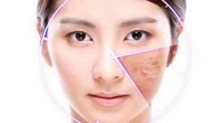 痘痘把白色的挤出来是不是好得快,皮肤上有痘痘挤出来白色米粒