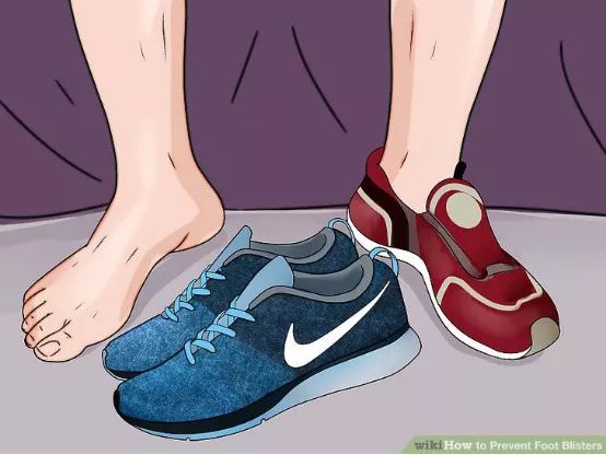 怎么预防跑步起水泡,一到夏天跑步脚就起泡怎么办