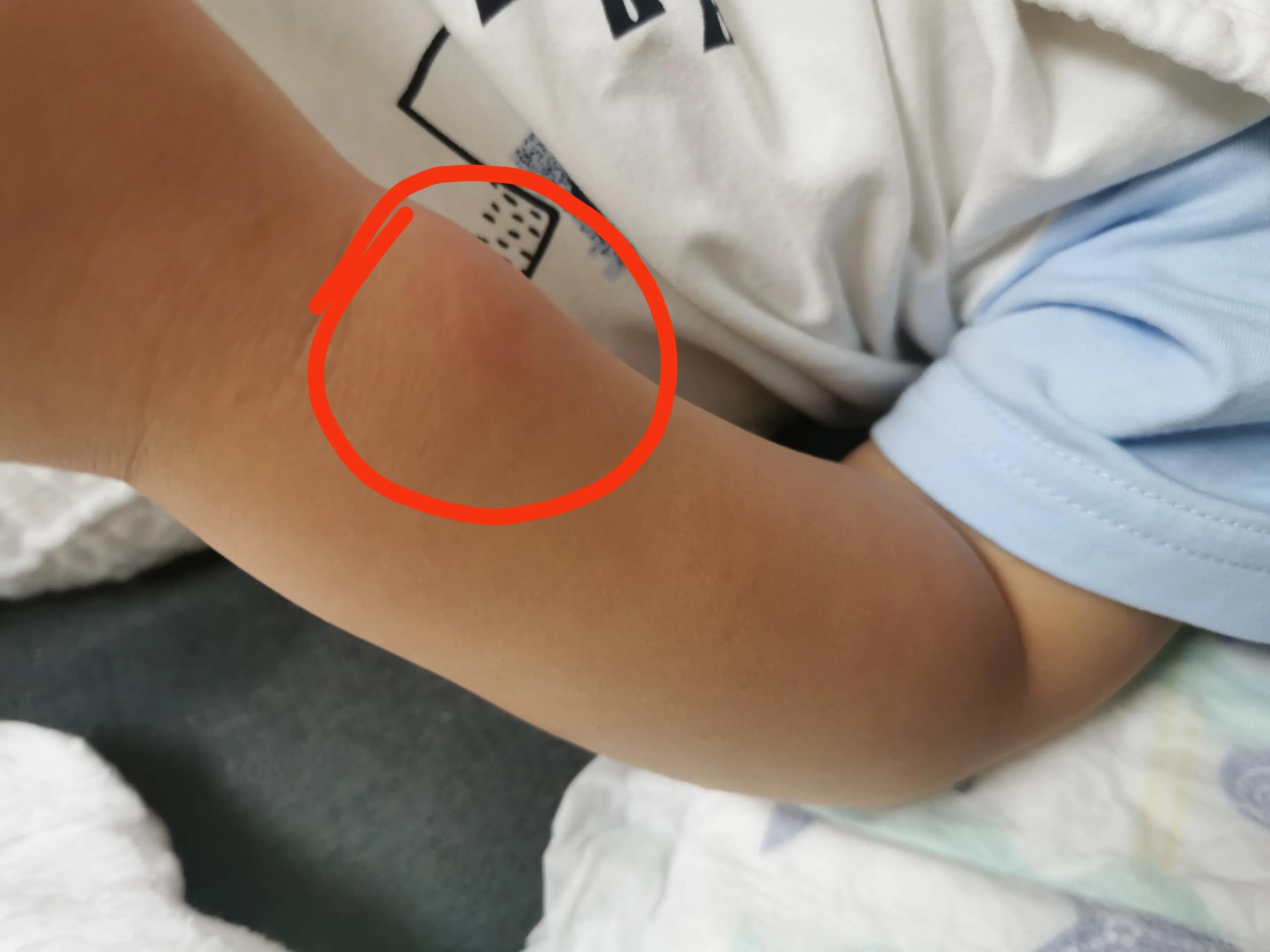 家有一个爱咬哥哥的弟弟，跟我一起这样做，弟弟不咬人啦