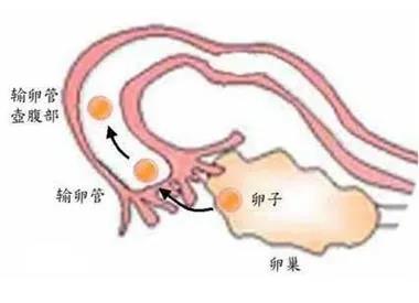 子宫后位怎么快速怀孕,子宫后位的人是不是不太容易怀孕